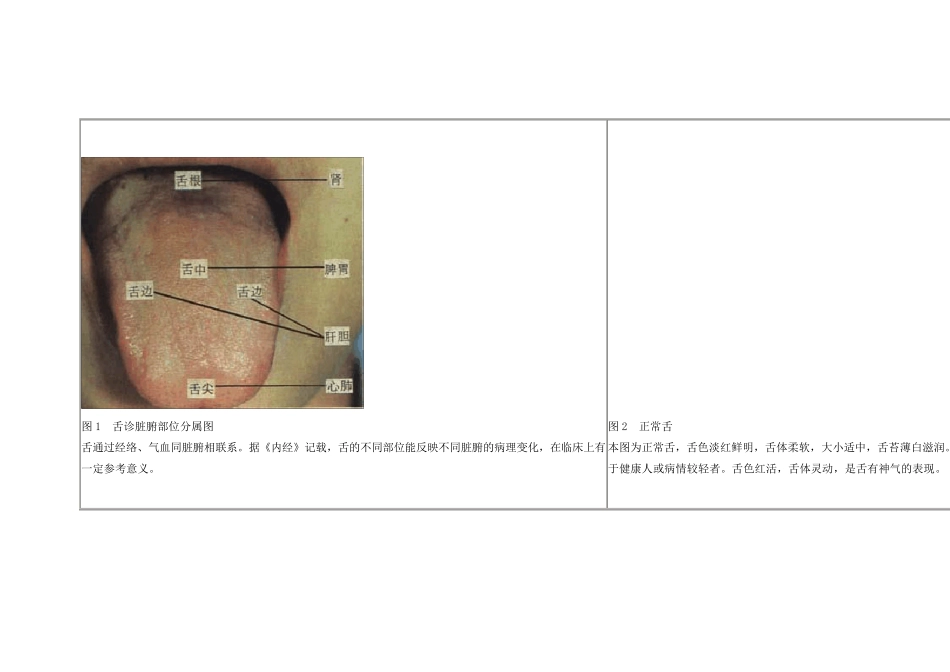 21舌苔望诊图谱_第1页