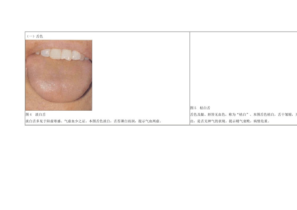 21舌苔望诊图谱_第2页