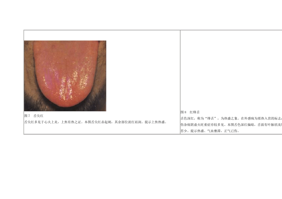 21舌苔望诊图谱_第3页