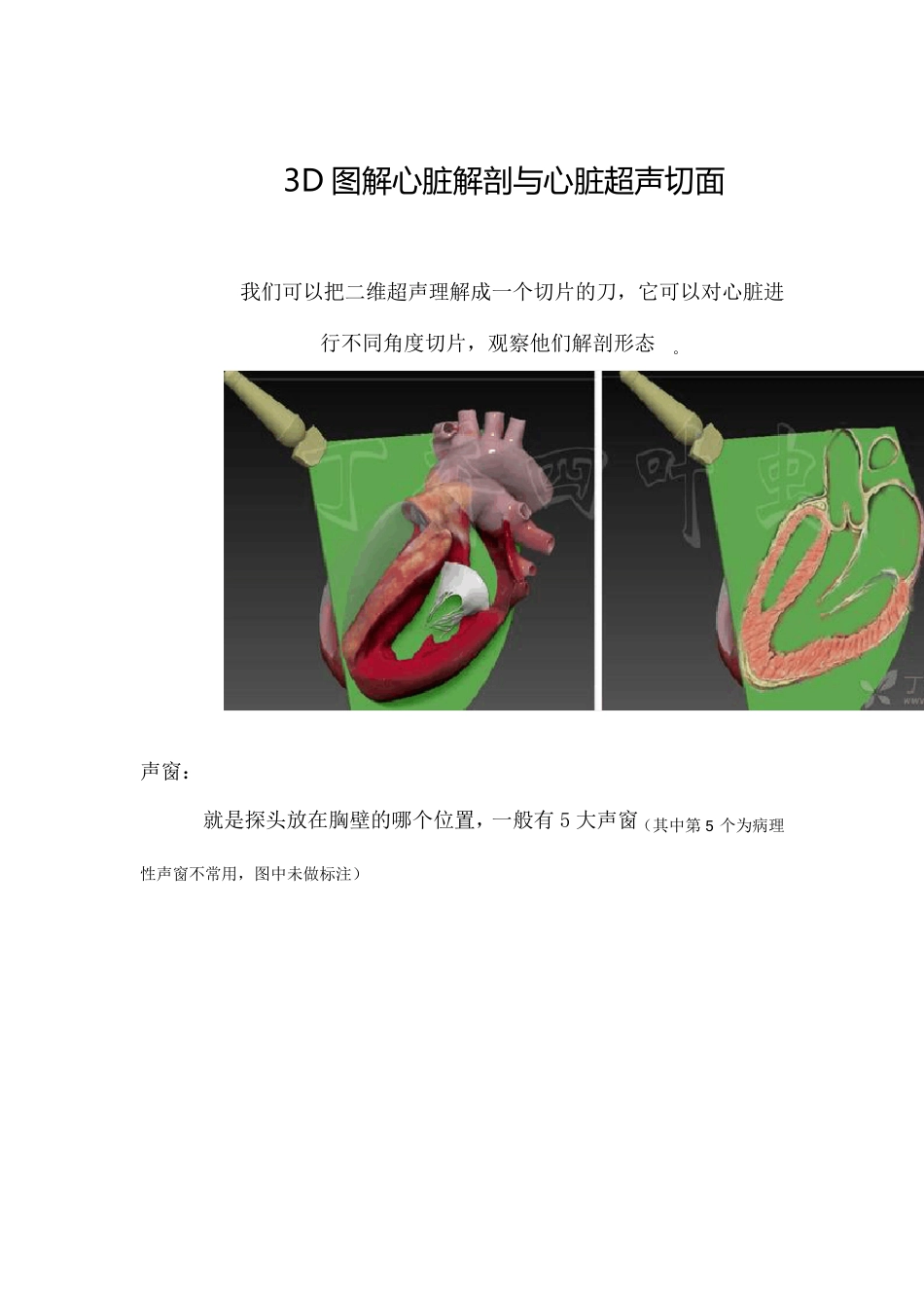 3D图解心脏解剖与心脏超声切面_第1页
