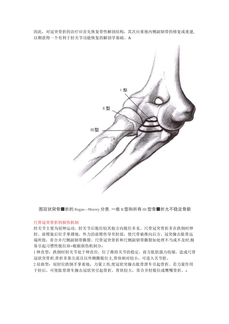 尺骨冠突骨折的分型及治疗_第2页