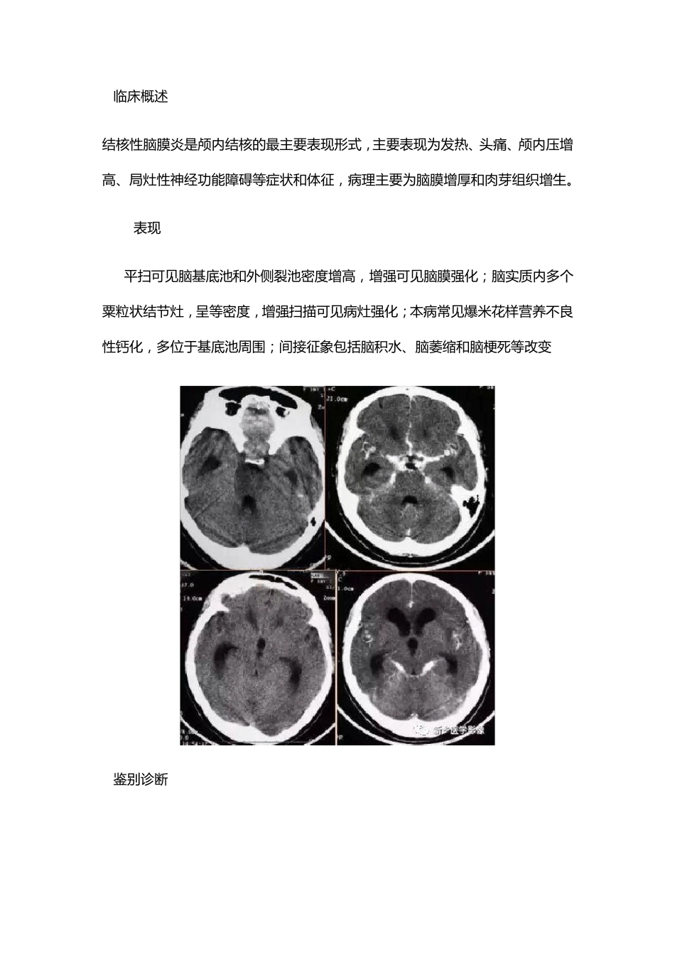 7种颅内感染_第3页