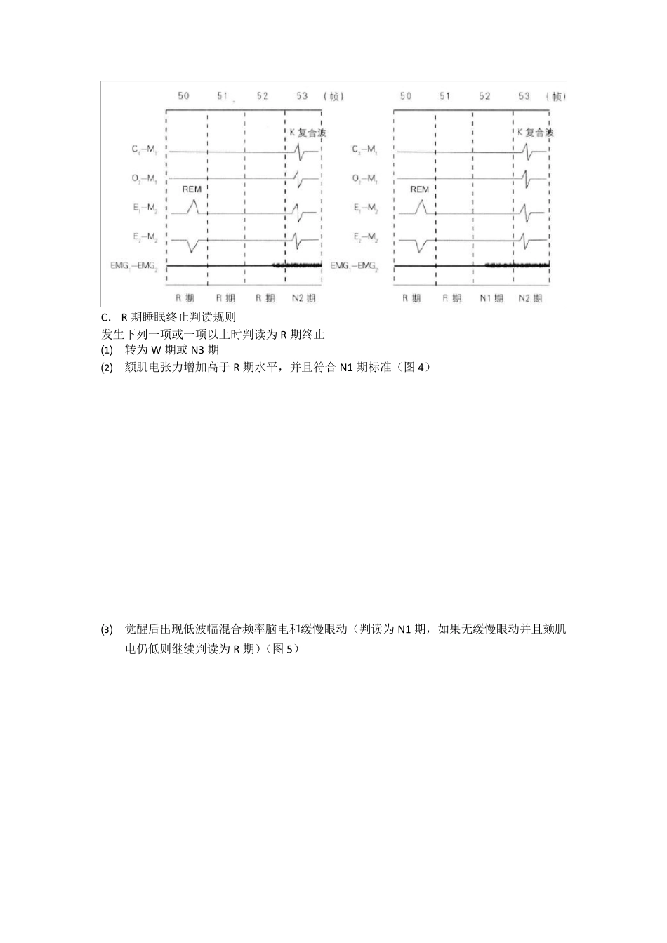 AASM2007精简版_第3页
