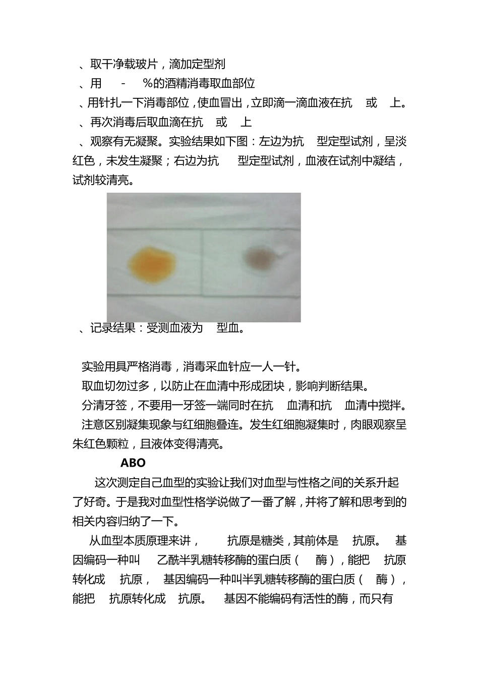 ABO血型鉴定实验报告_第2页