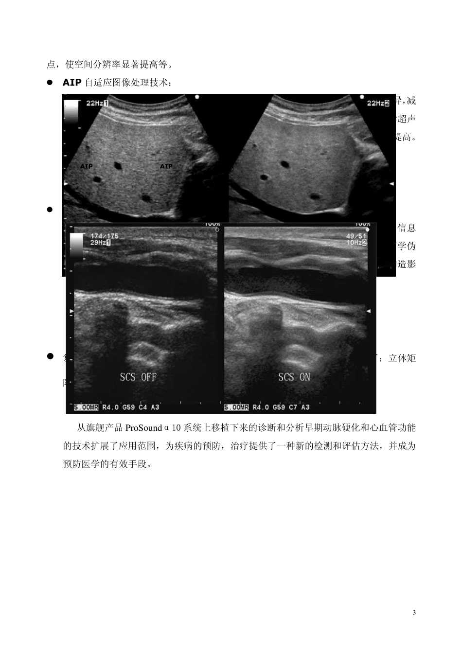 alokaprosounda7技术特点简介_第3页
