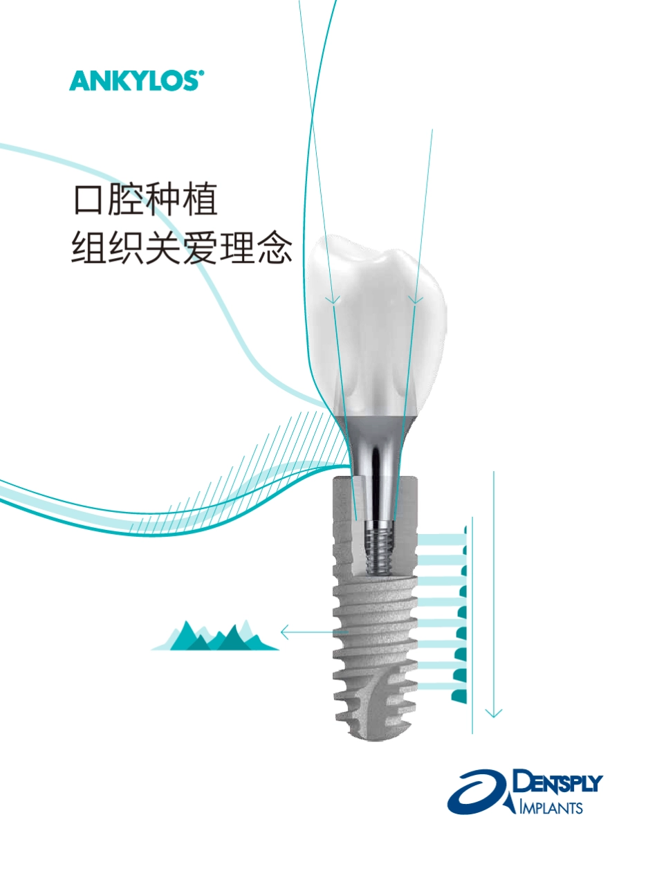ANKYLOS系统介绍_组织关爱_第1页