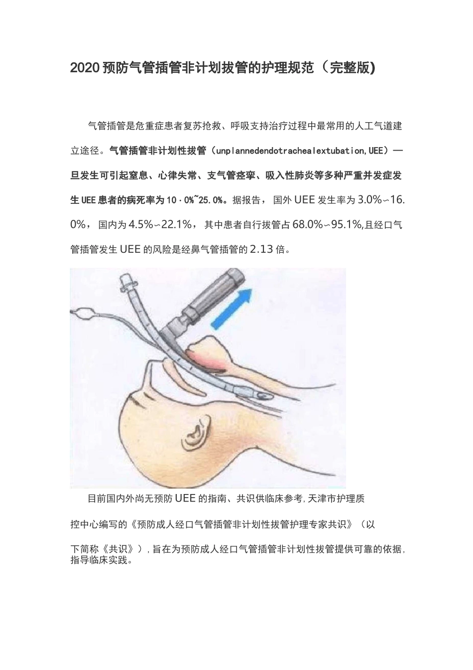 2020预防气管插管非计划拔管的护理规范(完整版)_第1页