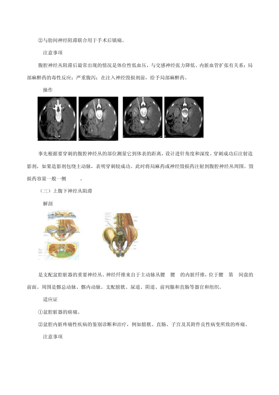 Ct引导下的疼痛介入治疗_第3页
