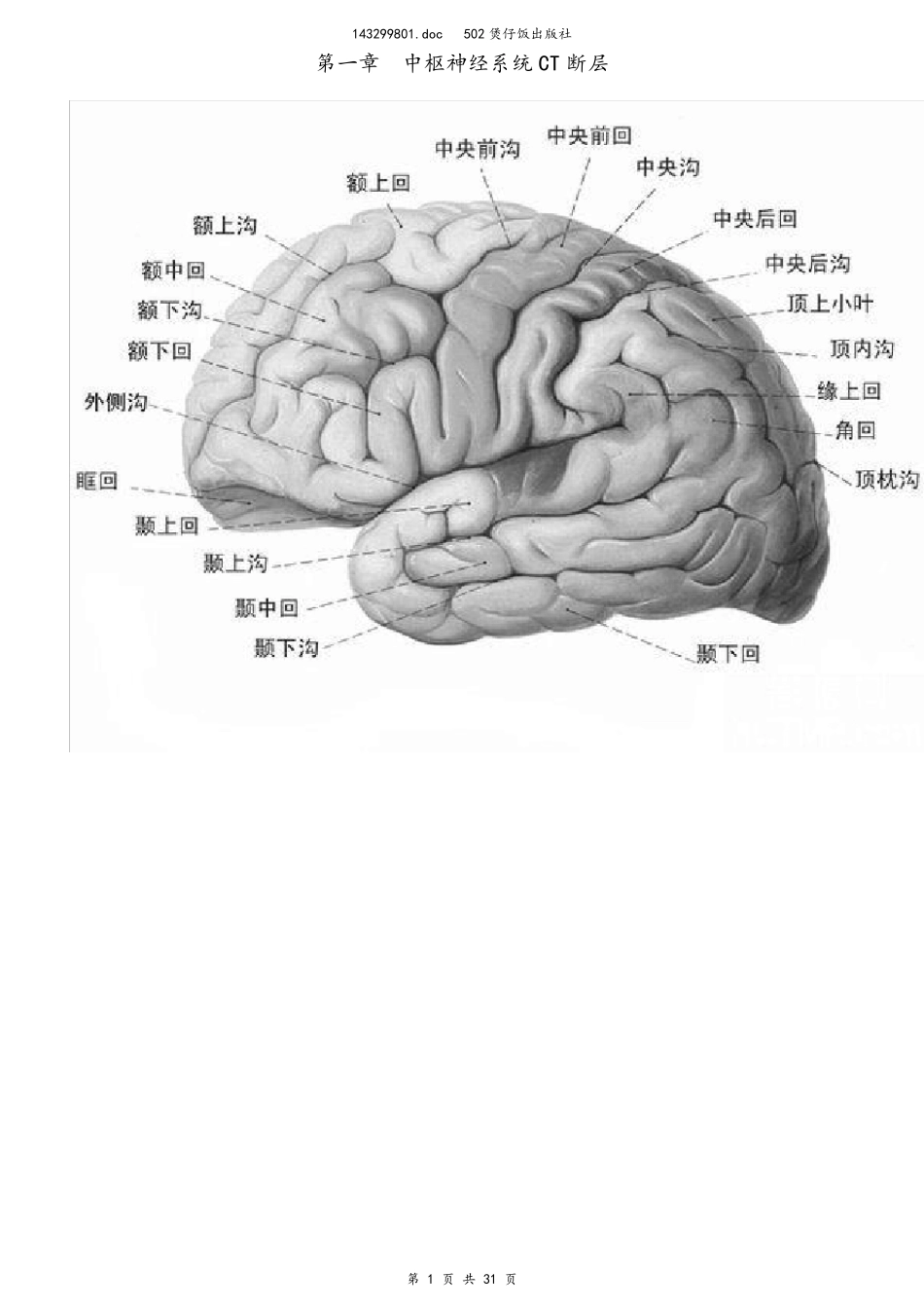 CT诊断图谱_第1页