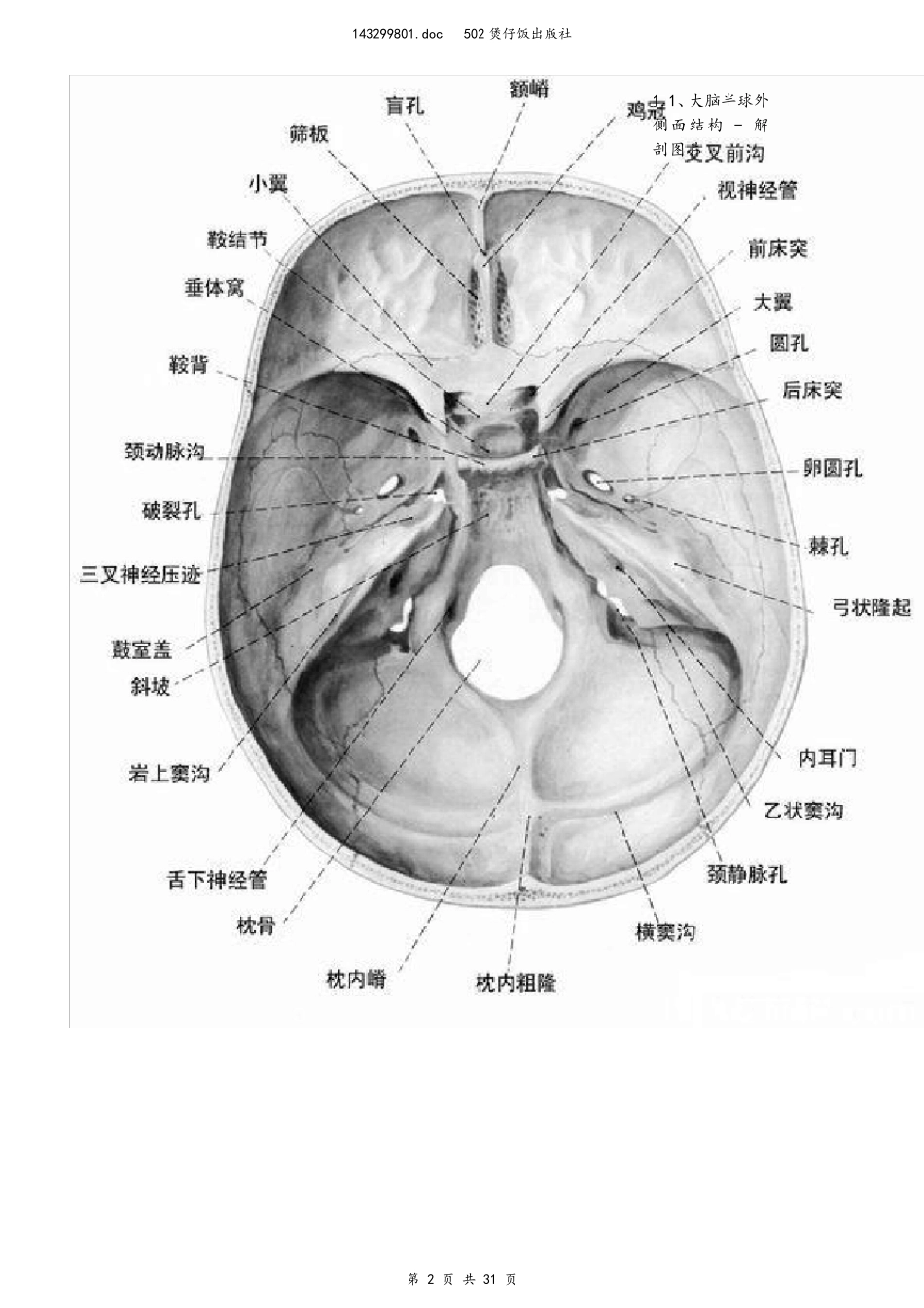 CT诊断图谱_第2页