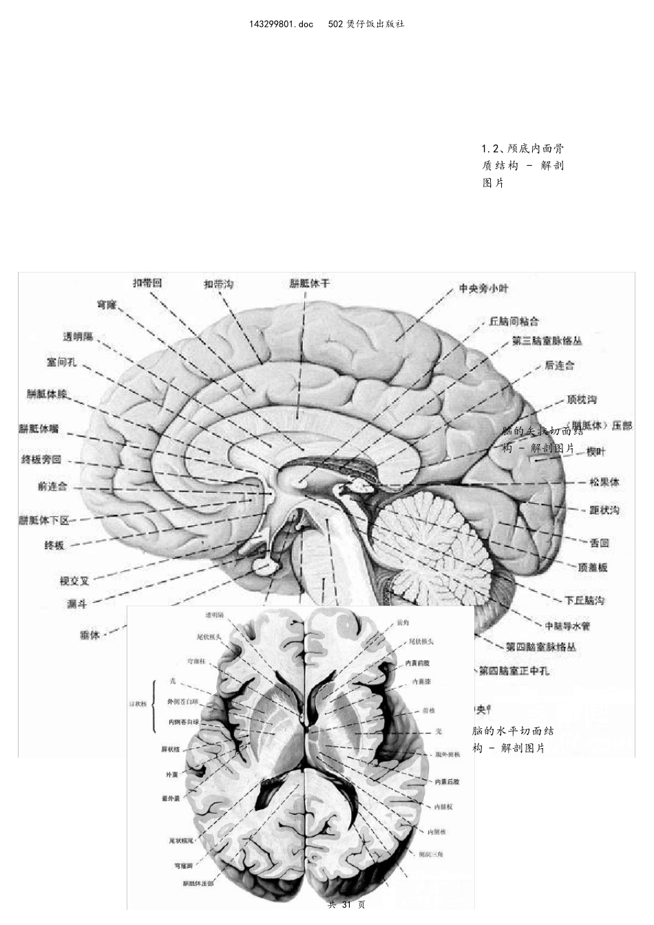 CT诊断图谱_第3页