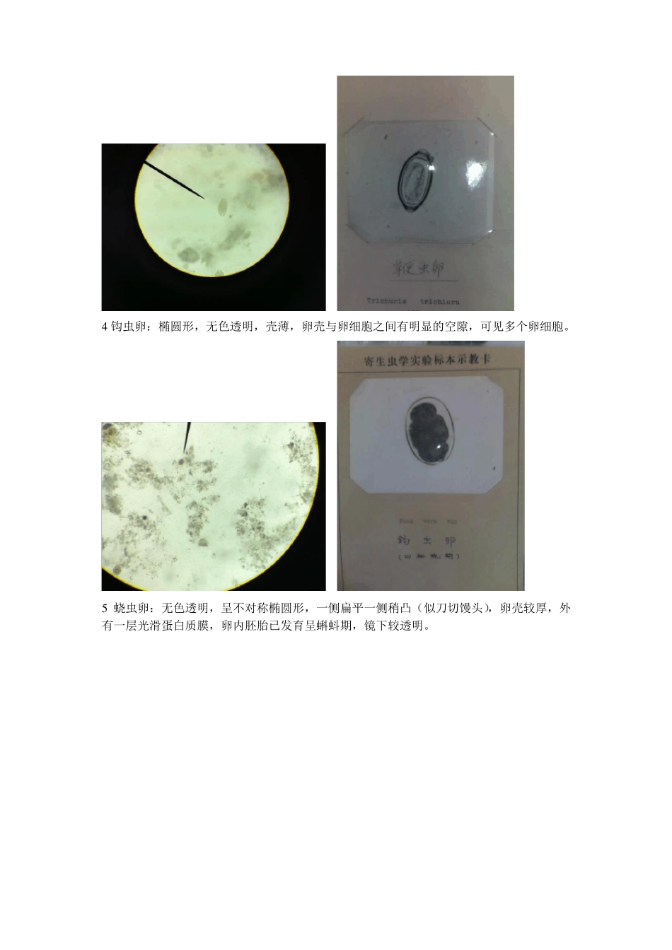 寄生虫试验鉴别要点_第2页