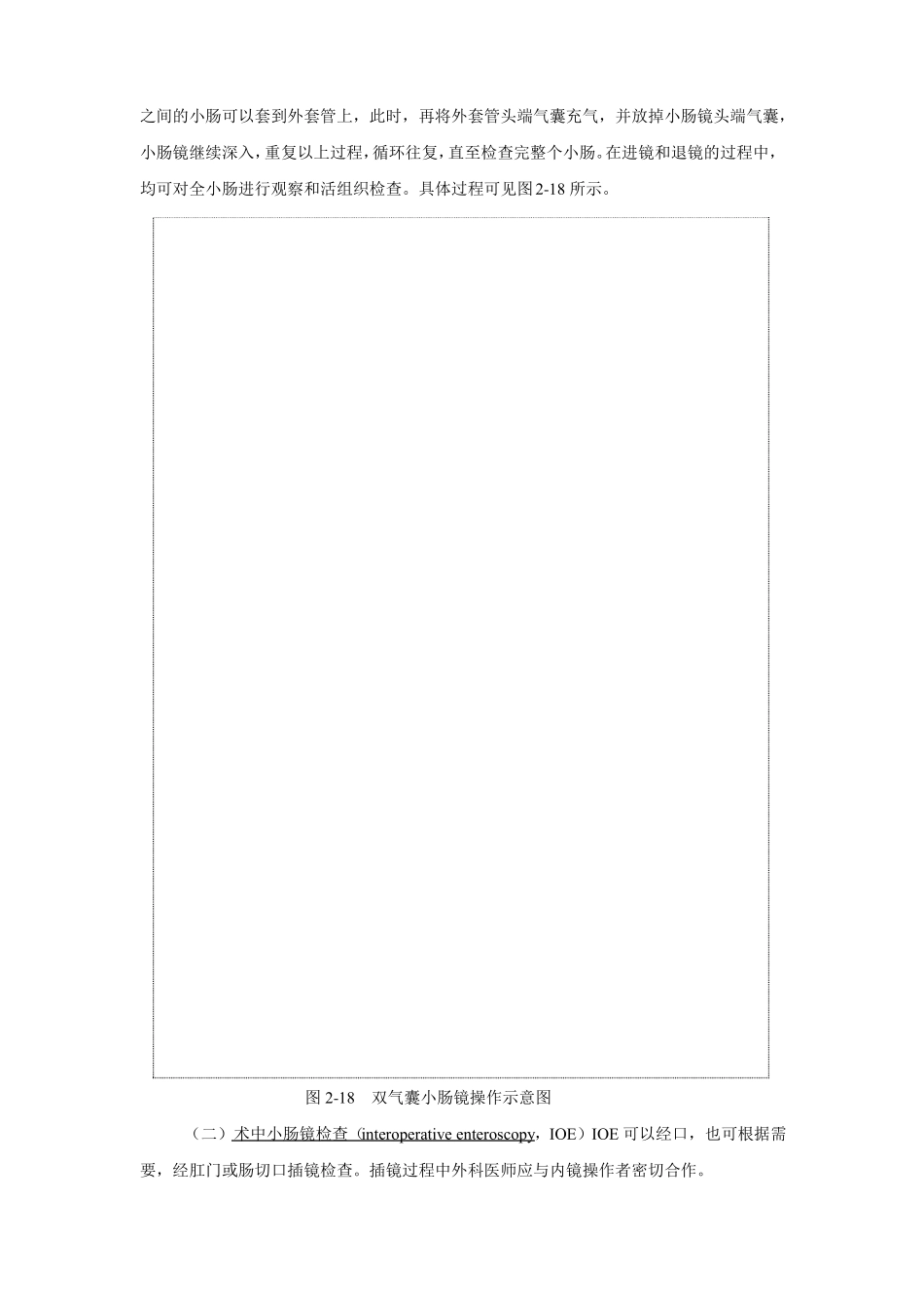 小肠镜检查术_第3页