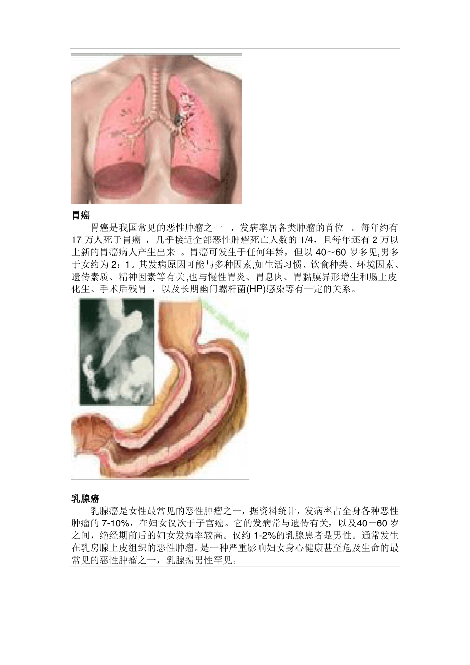 常见的10大恶性肿瘤是哪些_第2页
