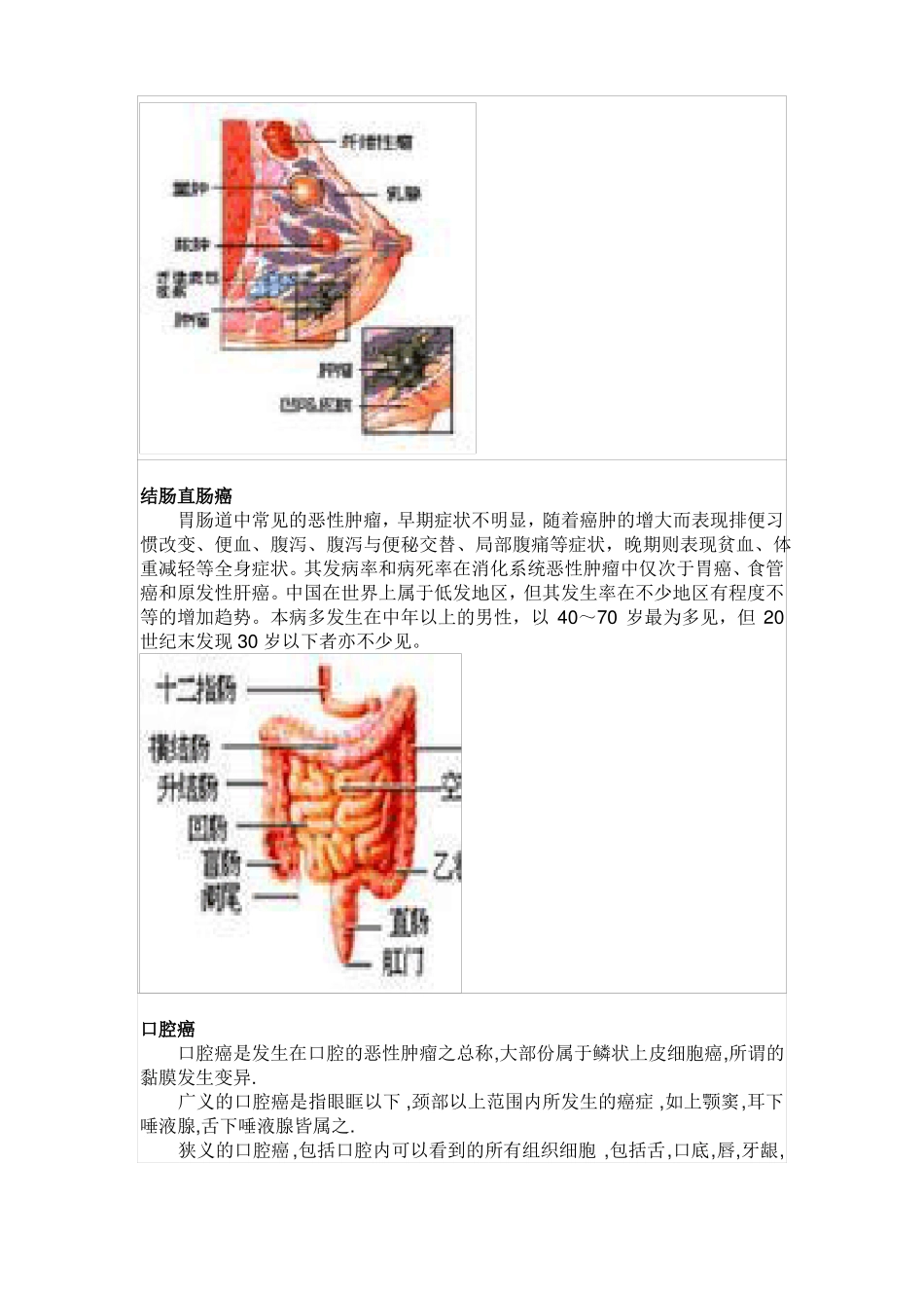 常见的10大恶性肿瘤是哪些_第3页