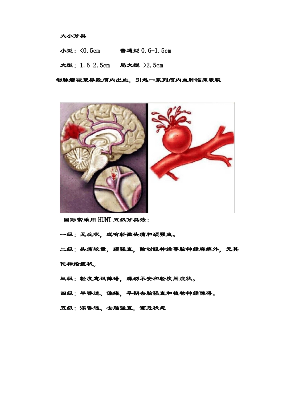 开颅动脉瘤夹闭术_第2页