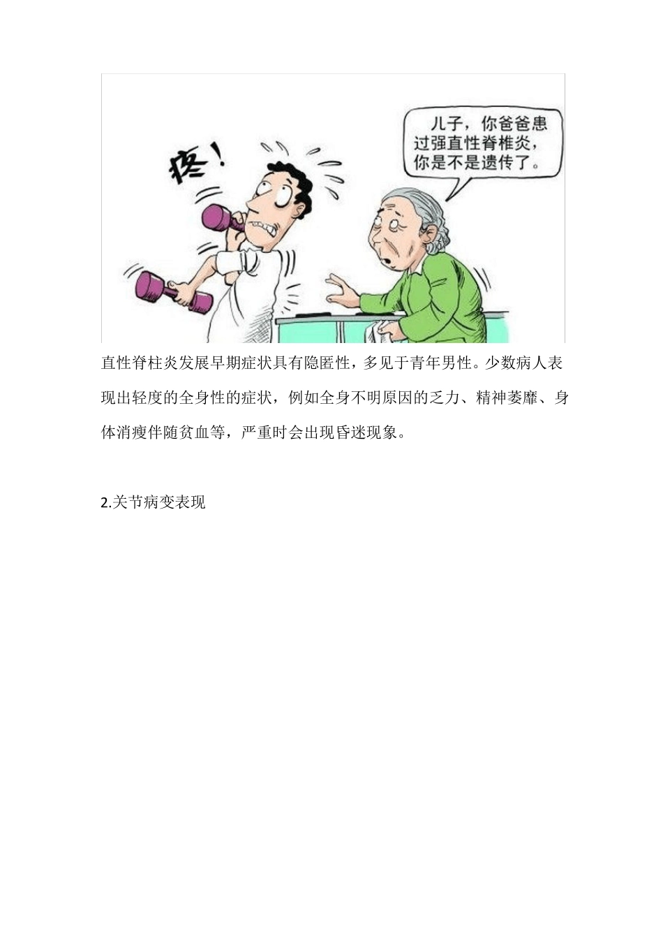 强直性脊柱炎_第2页