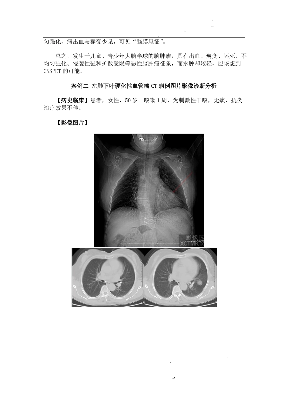 影像诊断学案例_第3页