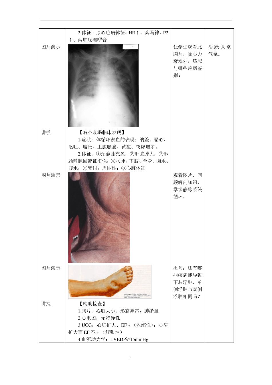 心血管内科心内科_见习教案_心力衰竭_第3页