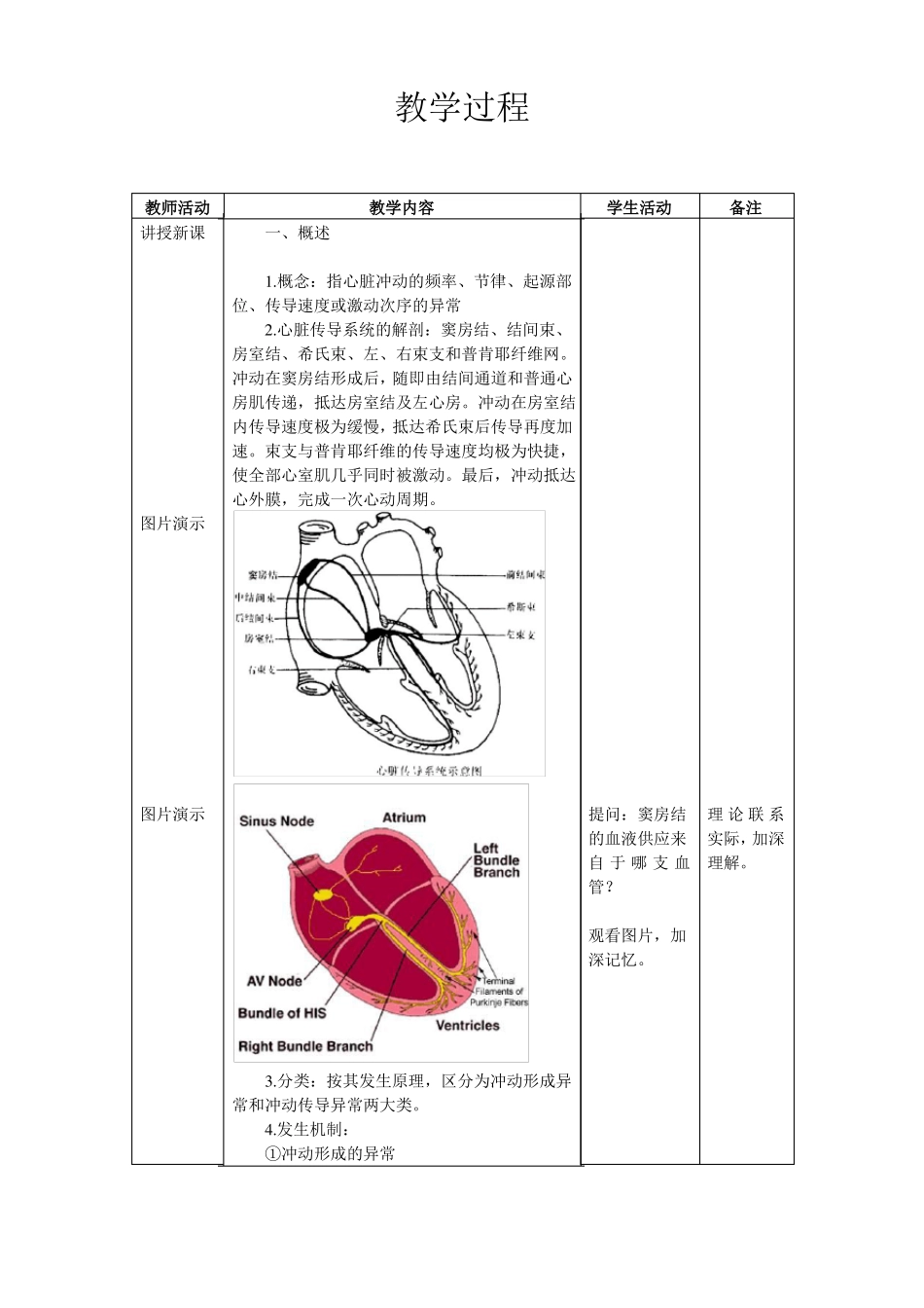 心血管内科心内科见习教案4心律失常_第2页