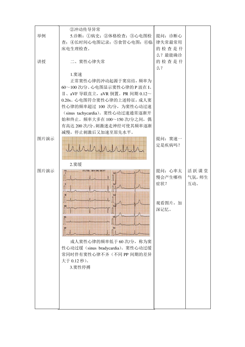 心血管内科心内科见习教案4心律失常_第3页