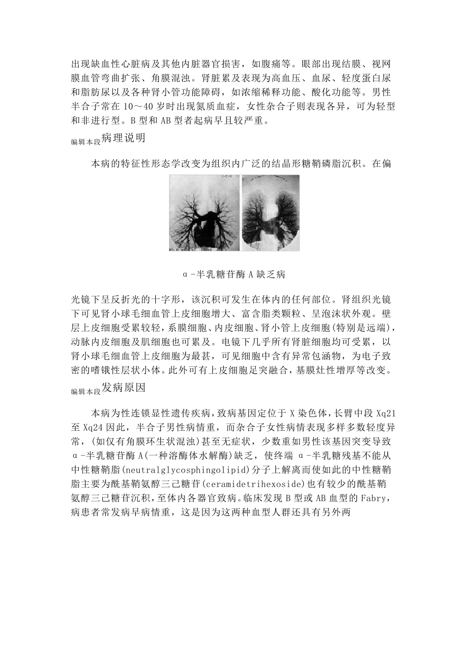 Fabry病_第3页