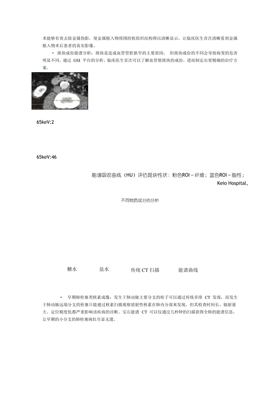 GEDiscoveryCT750HD宝石能谱CT_第2页