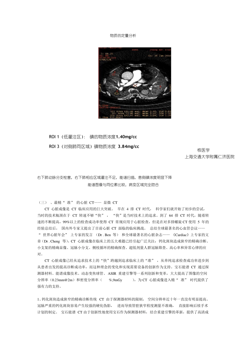GEDiscoveryCT750HD宝石能谱CT_第3页
