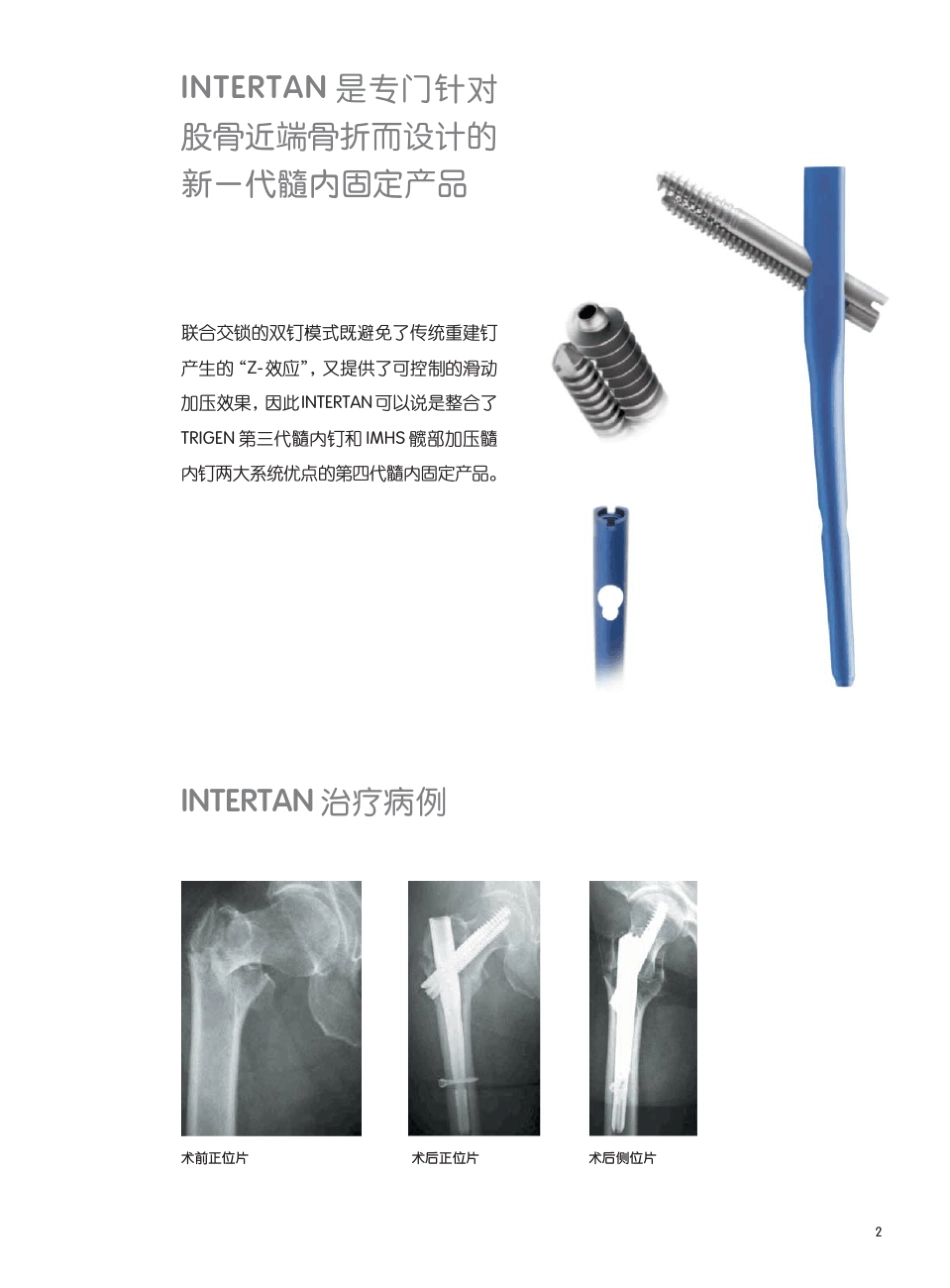 INTERTAN手术技术_第3页