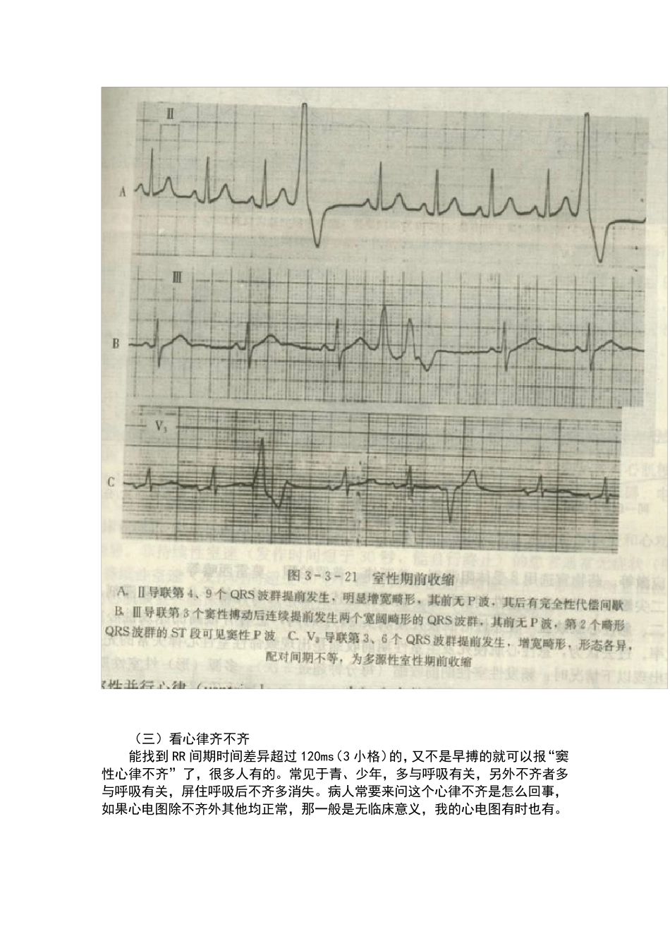 一份正常的心电图报告样式如下正常心电图报告_第3页