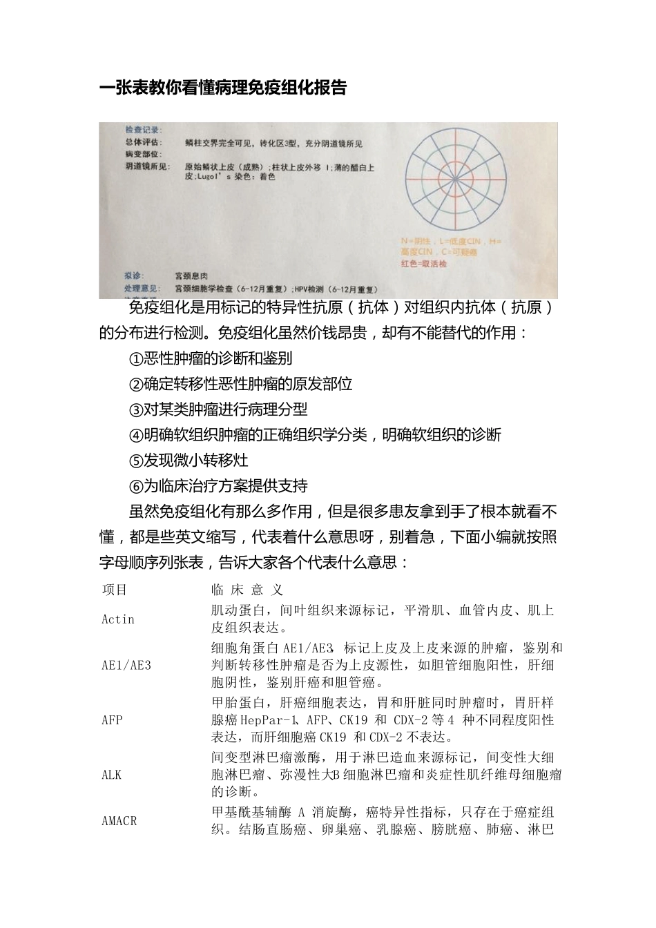 一张表教你看懂病理免疫组化报告_第1页