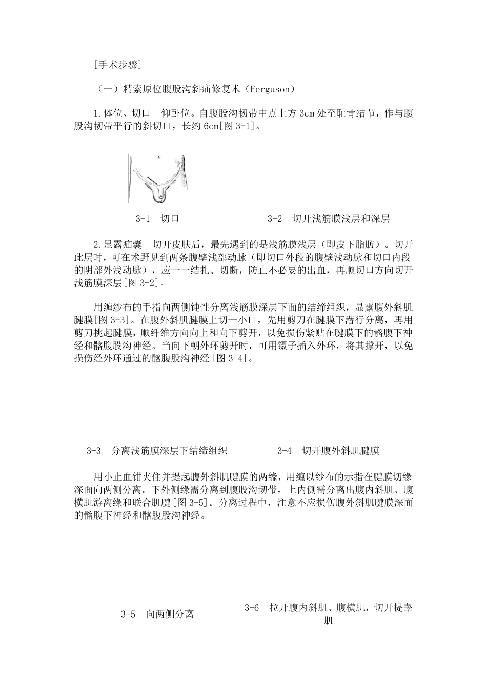 一般腹股沟斜疝修复术手术图谱_第3页