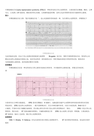 早期复极综合症