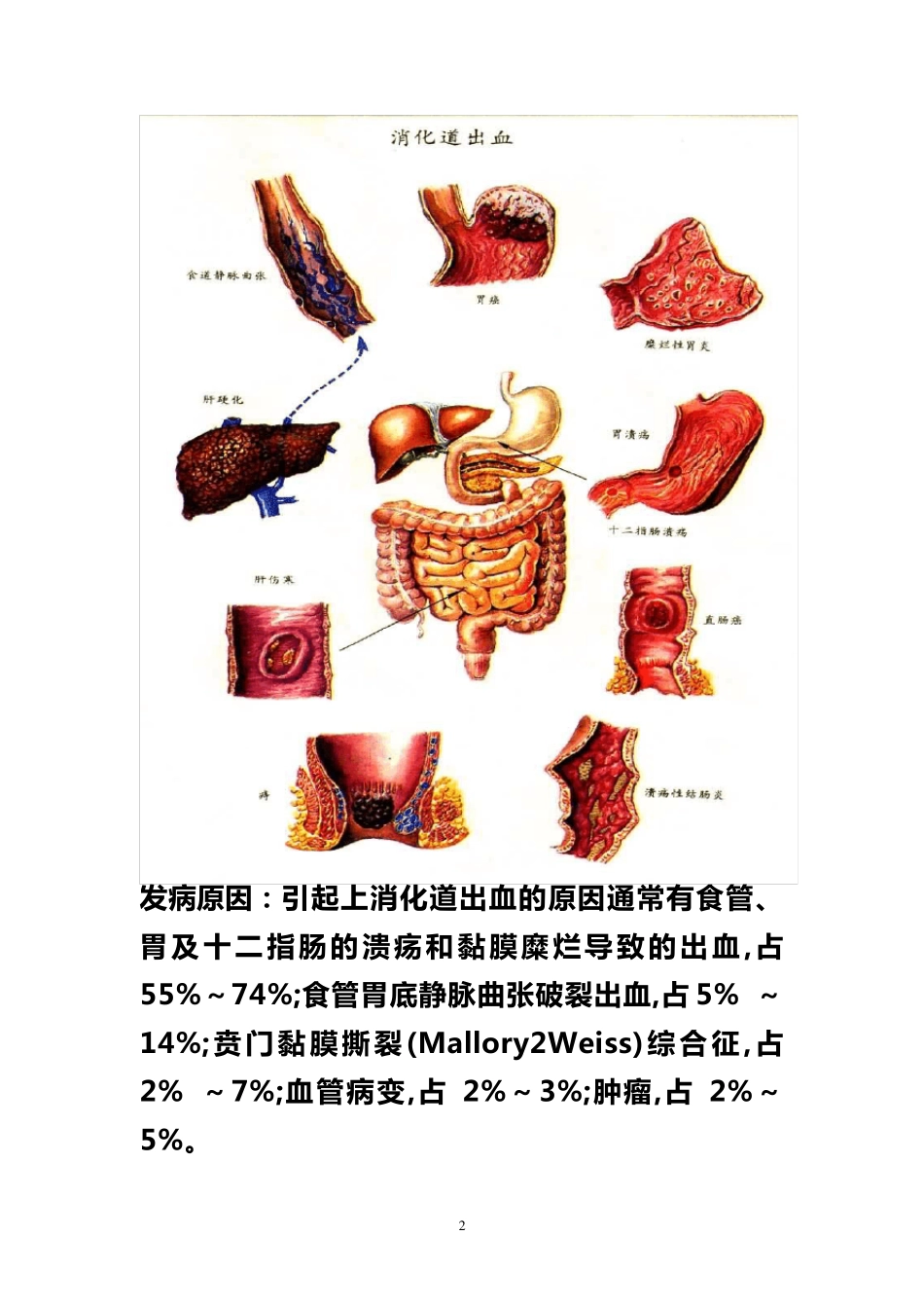 上消化道出血健康教育_第2页