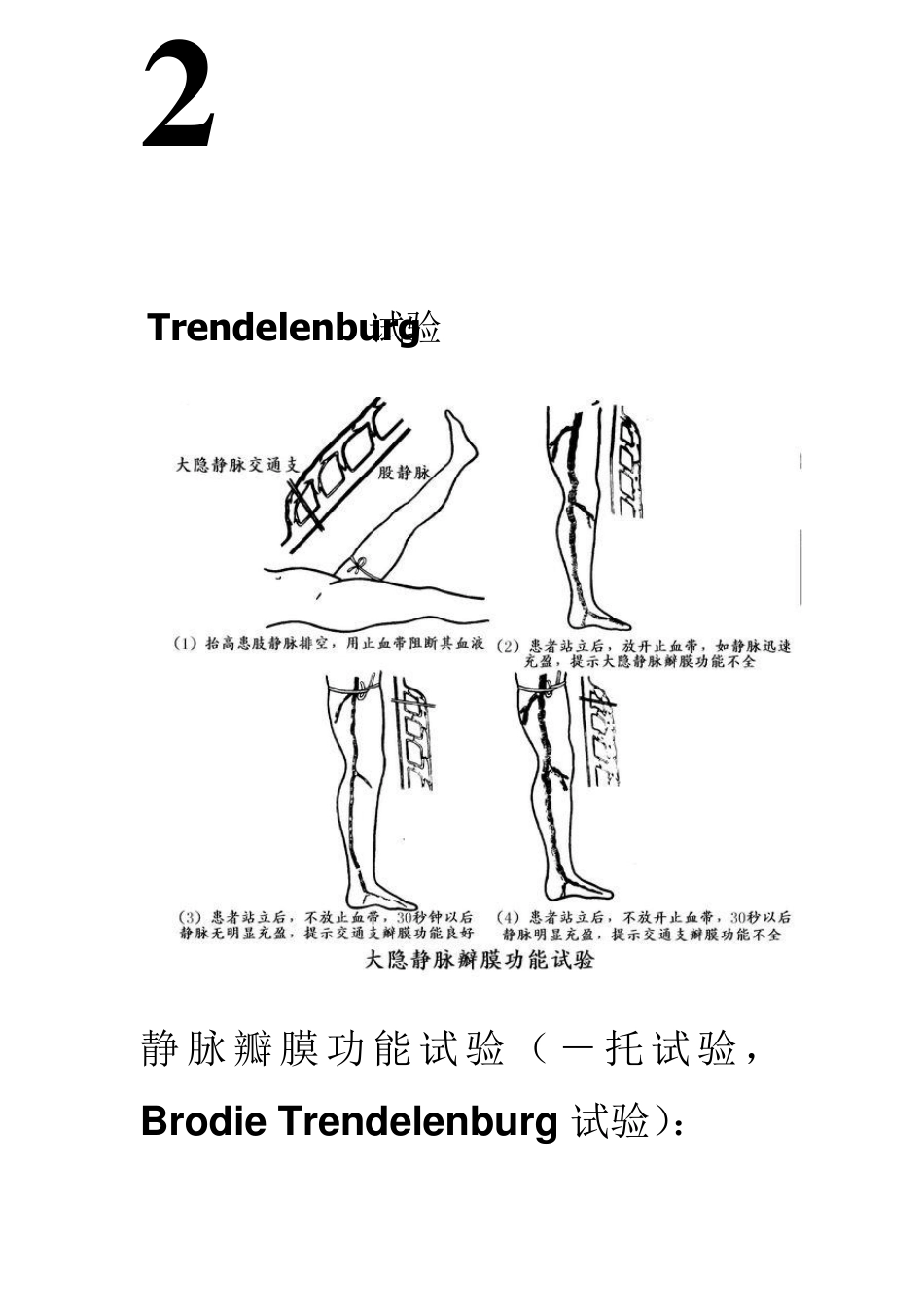 下肢静脉曲张三种检查方法_第3页