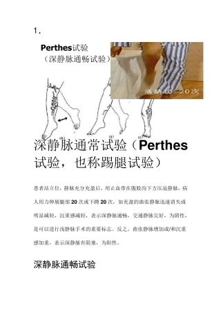 下肢静脉曲张三种检查方法