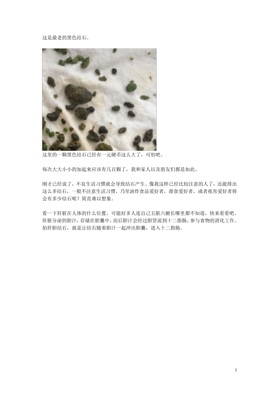 不用动手术无痛苦的肝脏清洗法[排肝胆结石]_第3页