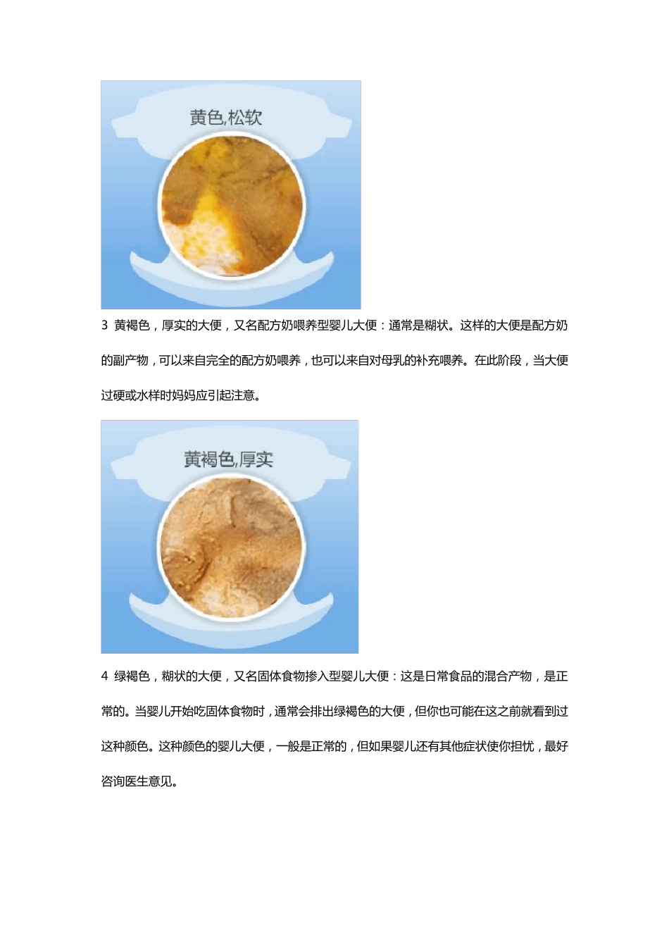 两个月宝宝大便婴儿大便十二种性状(多图)_第2页