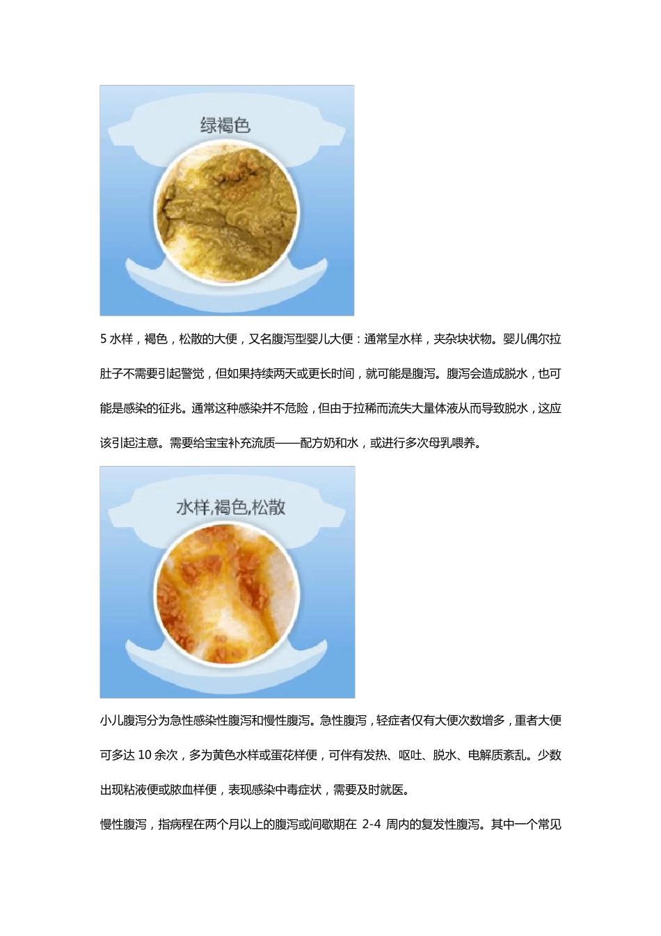 两个月宝宝大便婴儿大便十二种性状(多图)_第3页