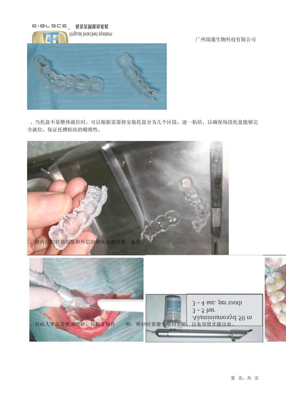 个性化舌侧矫正器临床操作指导_第2页