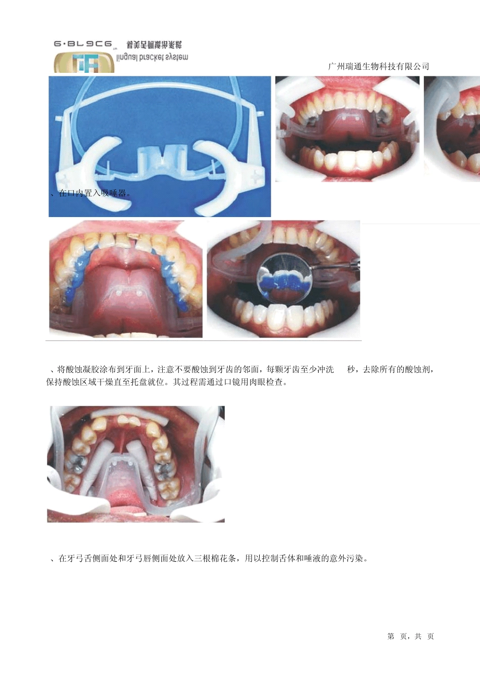 个性化舌侧矫正器临床操作指导_第3页