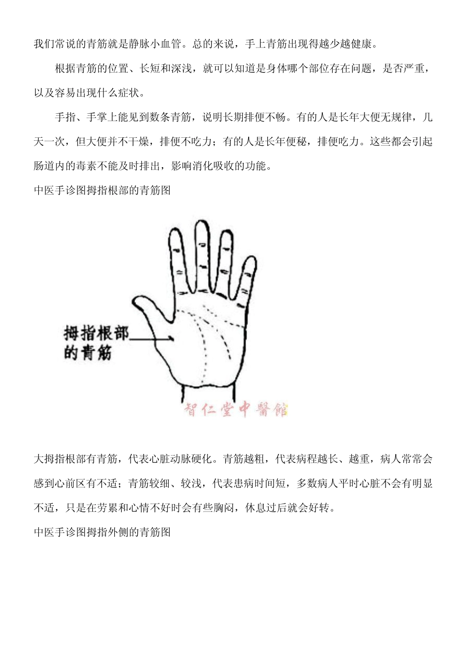 中医手诊图手心图_第3页