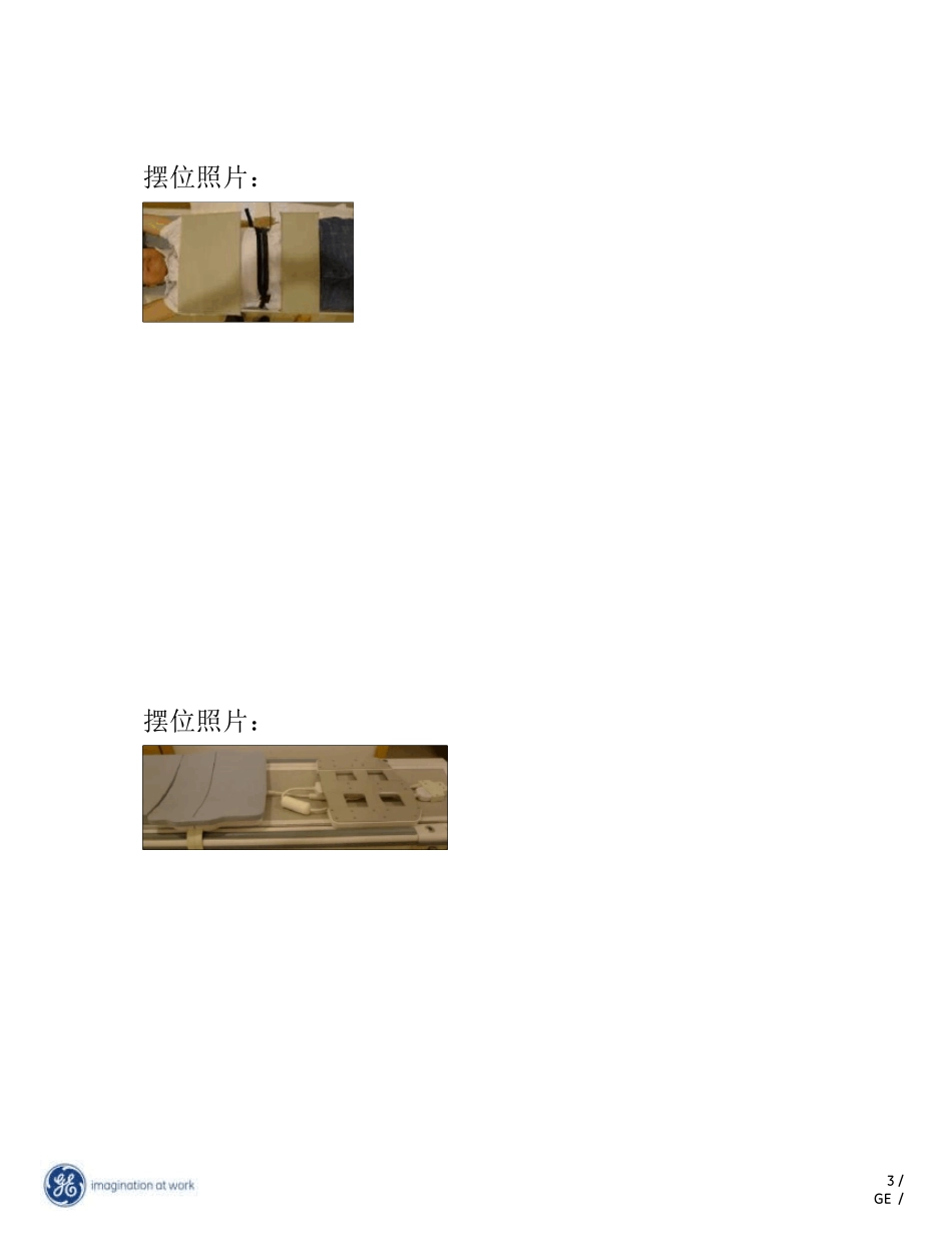 中华磁共振应用学院教材心脏冠脉规范化扫描方案_第3页