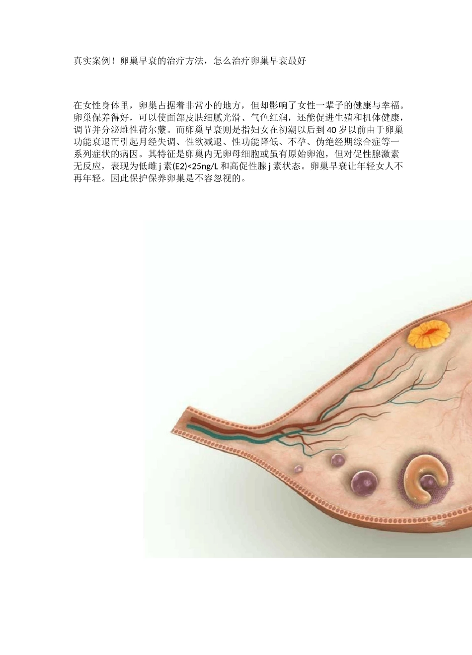 卵巢早衰的治疗方法,怎么治疗卵巢早衰最好_第1页