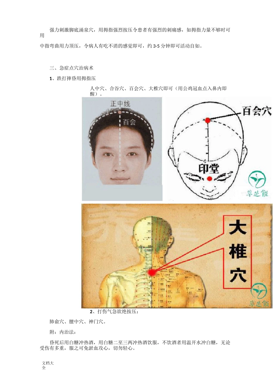 搜集了整整20个中医徒手点穴治病地方法,绝招!紧急时刻能救命_第3页