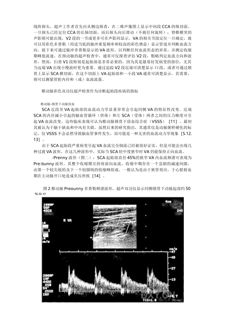 颅外椎动脉超声检查全解_第3页
