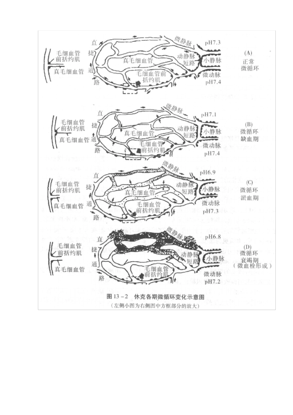休克的病理生理机制_第3页