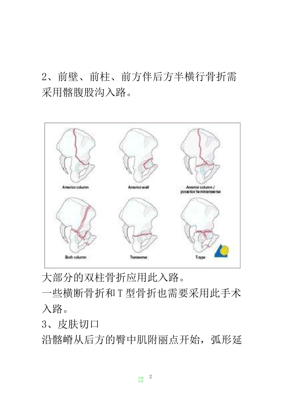 髂腹股沟入路解剖_第2页