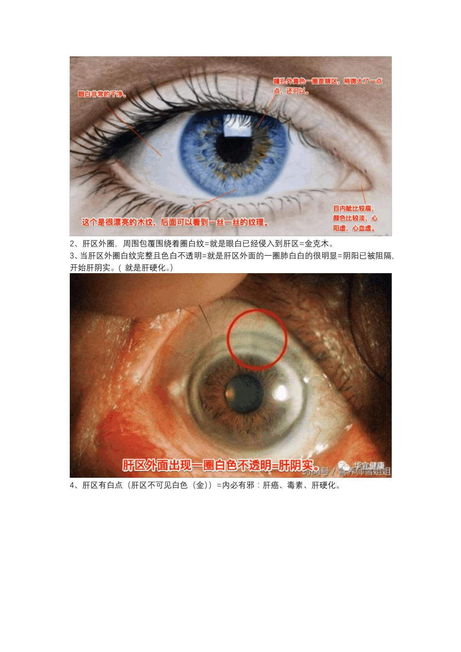 倪海厦眼诊总结_第3页