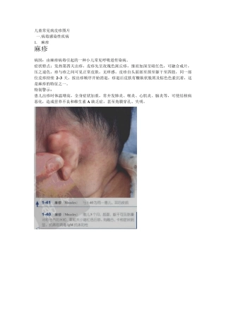 儿童常见病皮疹图片